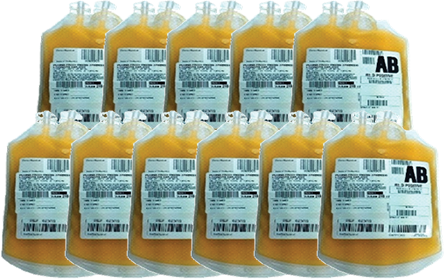 10-12 units of plasma, 250mL per bag
